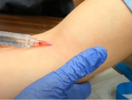 Преимущества кодирования Вивитролом Инъекция в руку